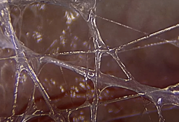 Fascia under the microscope